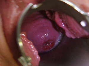 Врач домогается пациентку и пальцами ласкает киску